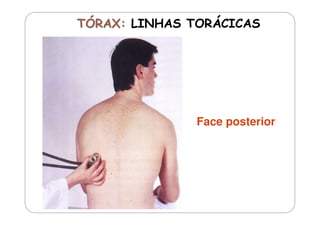 Face posterior

 