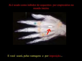 E você usará, pelas vantagens e por imposição...
Já é usado como inibidor de sequestros por empresários no
mundo inteiro.
 