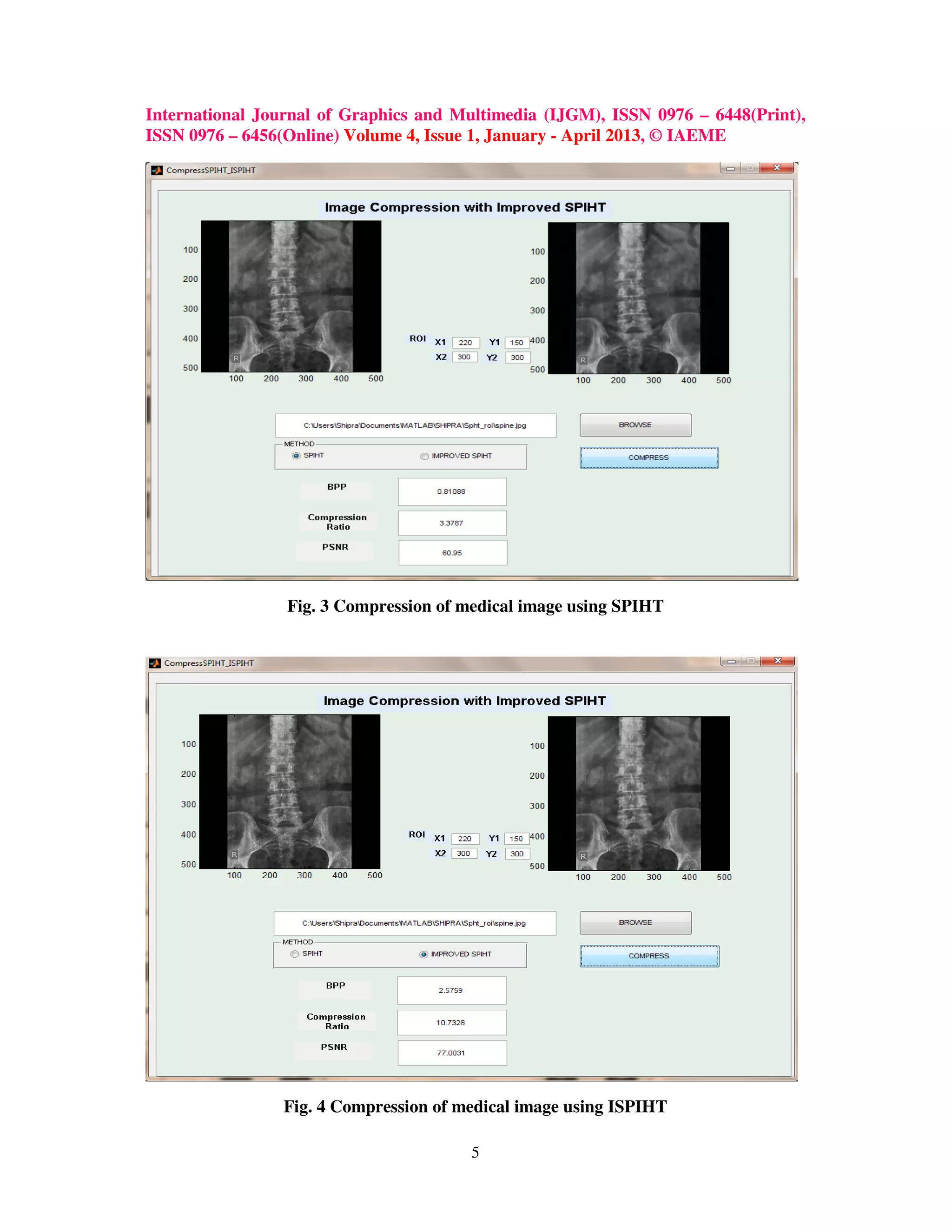 International Journal of Graphics and Multimedia (IJGM), ISSN 0976 – 6448(Print),
ISSN 0976 – 6456(Online) Volume 4, Issue 1, January - April 2013, © IAEME
5
Fig. 3 Compression of medical image using SPIHT
Fig. 4 Compression of medical image using ISPIHT
 