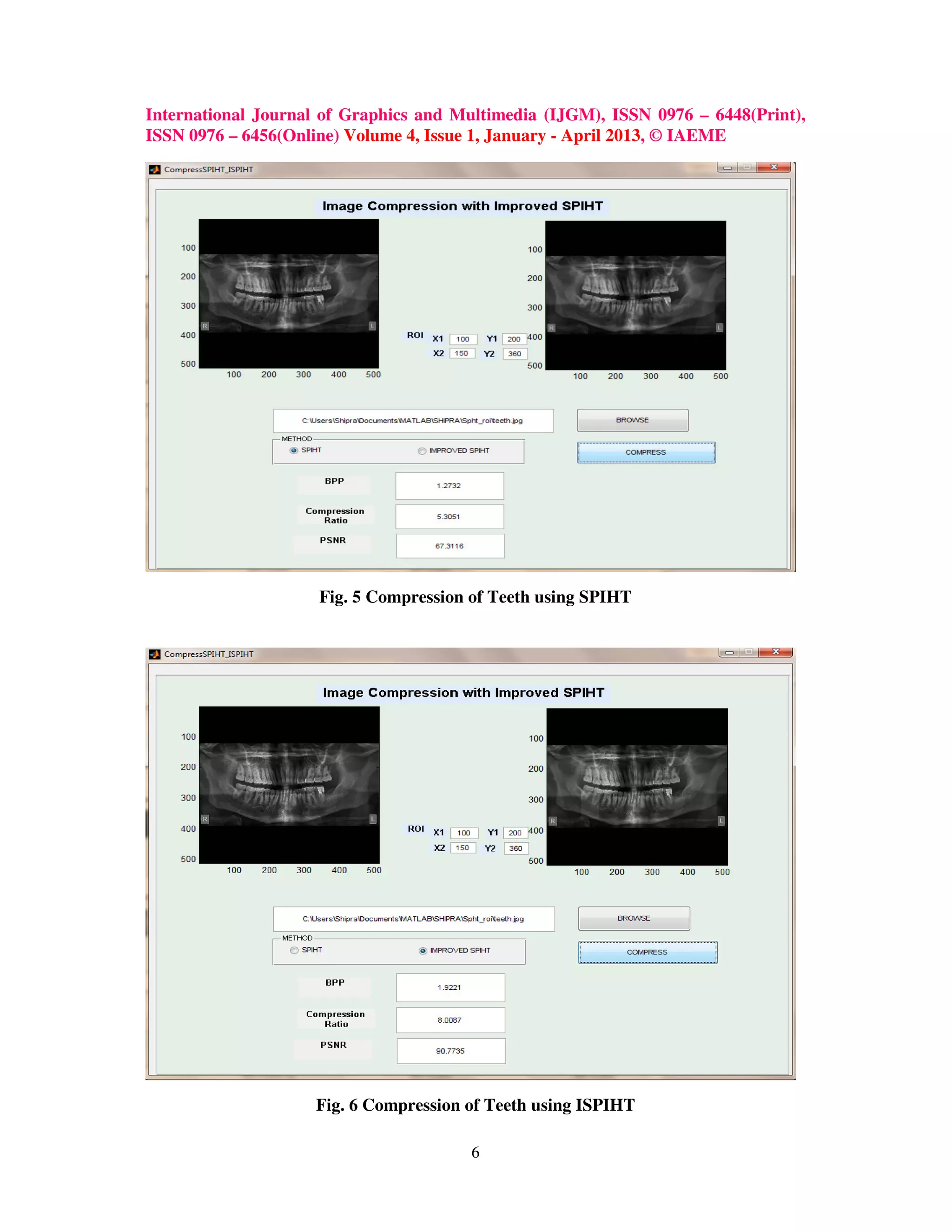 International Journal of Graphics and Multimedia (IJGM), ISSN 0976 – 6448(Print),
ISSN 0976 – 6456(Online) Volume 4, Issue 1, January - April 2013, © IAEME
6
Fig. 5 Compression of Teeth using SPIHT
Fig. 6 Compression of Teeth using ISPIHT
 