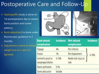 An Overview of Bariatric Surgery- shaheed.pptx