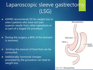 An Overview of Bariatric Surgery- shaheed.pptx