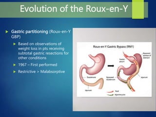 An Overview of Bariatric Surgery- shaheed.pptx