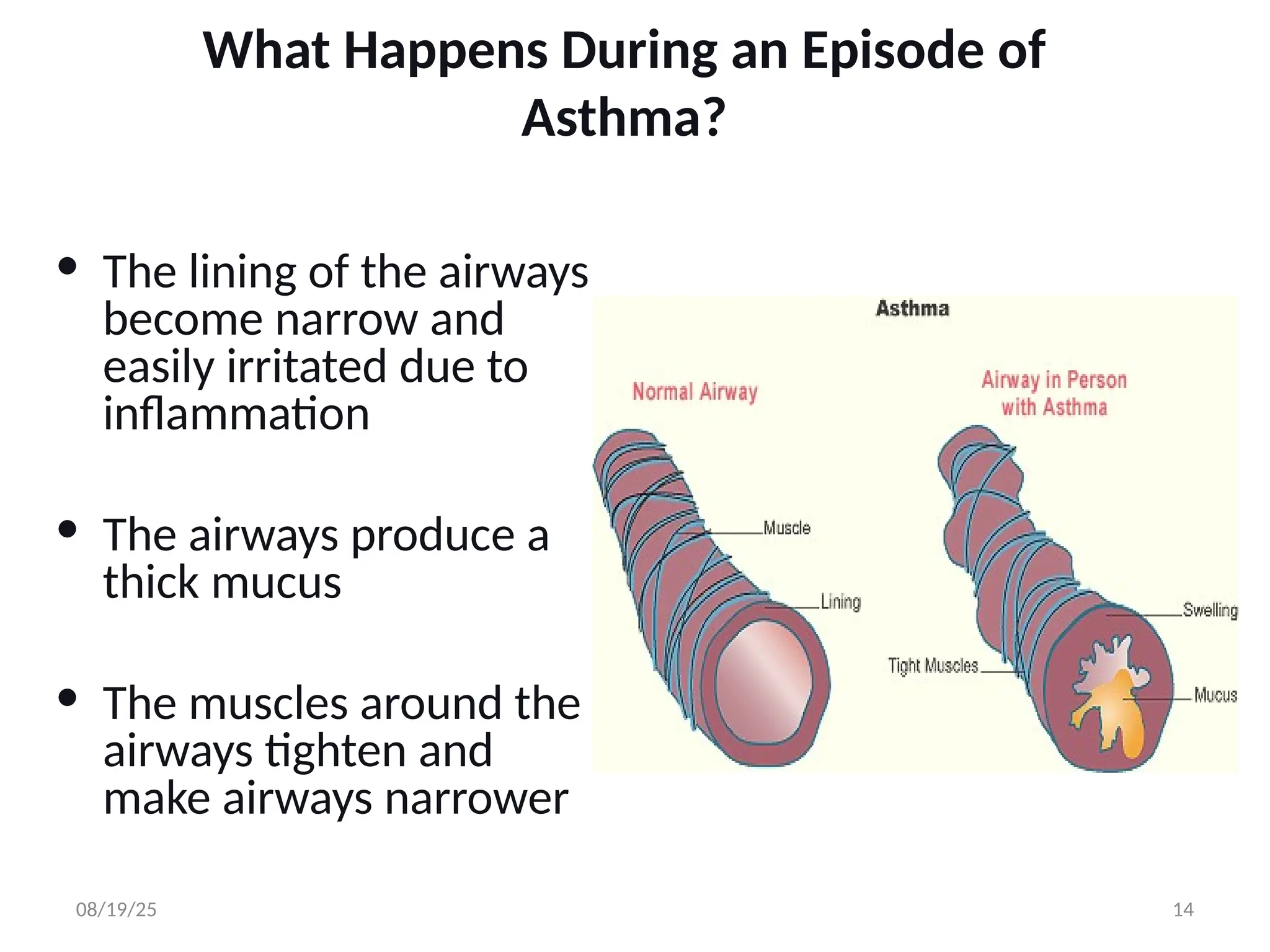 What Happens During an Episode of
Asthma?
• The lining of the airways
become narrow and
easily irritated due to
inflammation
• The airways produce a
thick mucus
• The muscles around the
airways tighten and
make airways narrower
08/19/25 14
 