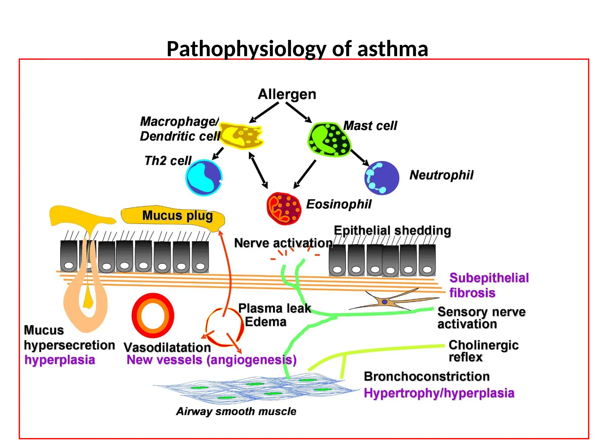 Pathophysiology of asthma
 