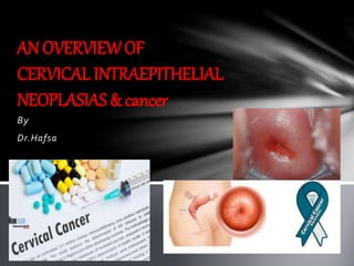 By
Dr.Hafsa
AN OVERVIEWOF
CERVICAL INTRAEPITHELIAL
NEOPLASIAS & cancer
 