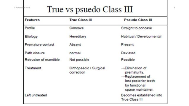 An overview of class III treatment in fixed Orthodontics by MBT system ...