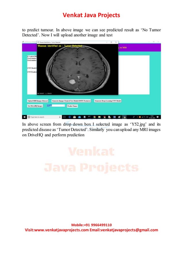 An overview of deep learning in medical imaging focusing on mri ...