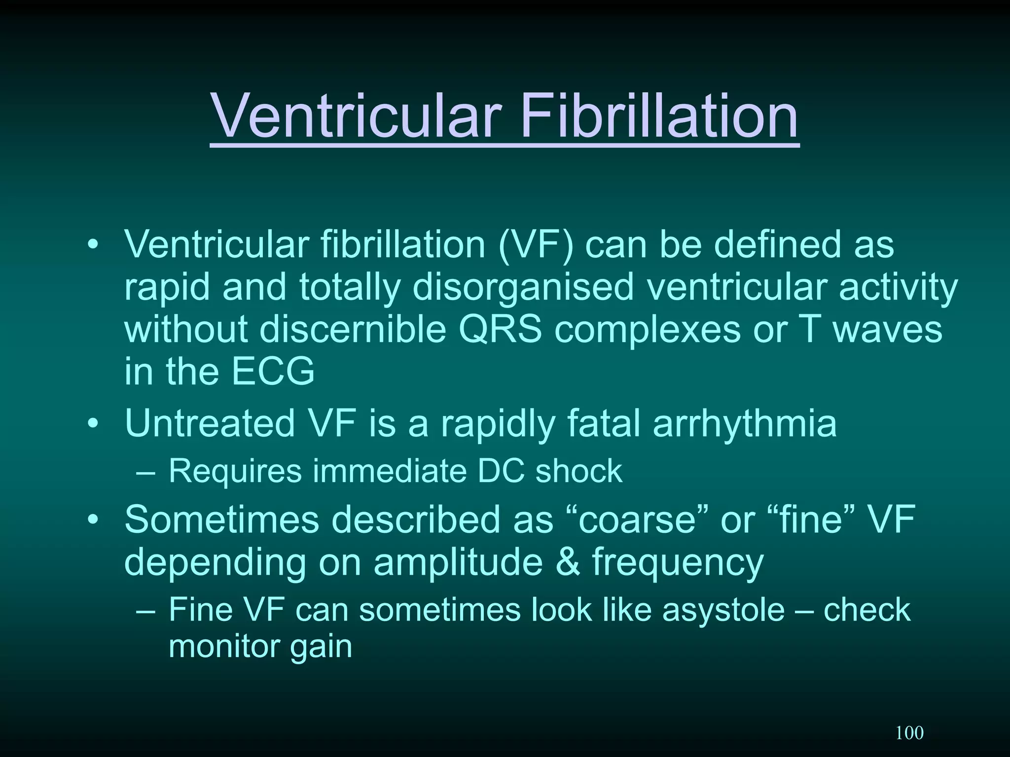 100
Ventricular Fibrillation
• Ventricular fibrillation (VF) can be defined as
rapid and totally disorganised ventricular activity
without discernible QRS complexes or T waves
in the ECG
• Untreated VF is a rapidly fatal arrhythmia
– Requires immediate DC shock
• Sometimes described as “coarse” or “fine” VF
depending on amplitude & frequency
– Fine VF can sometimes look like asystole – check
monitor gain
 