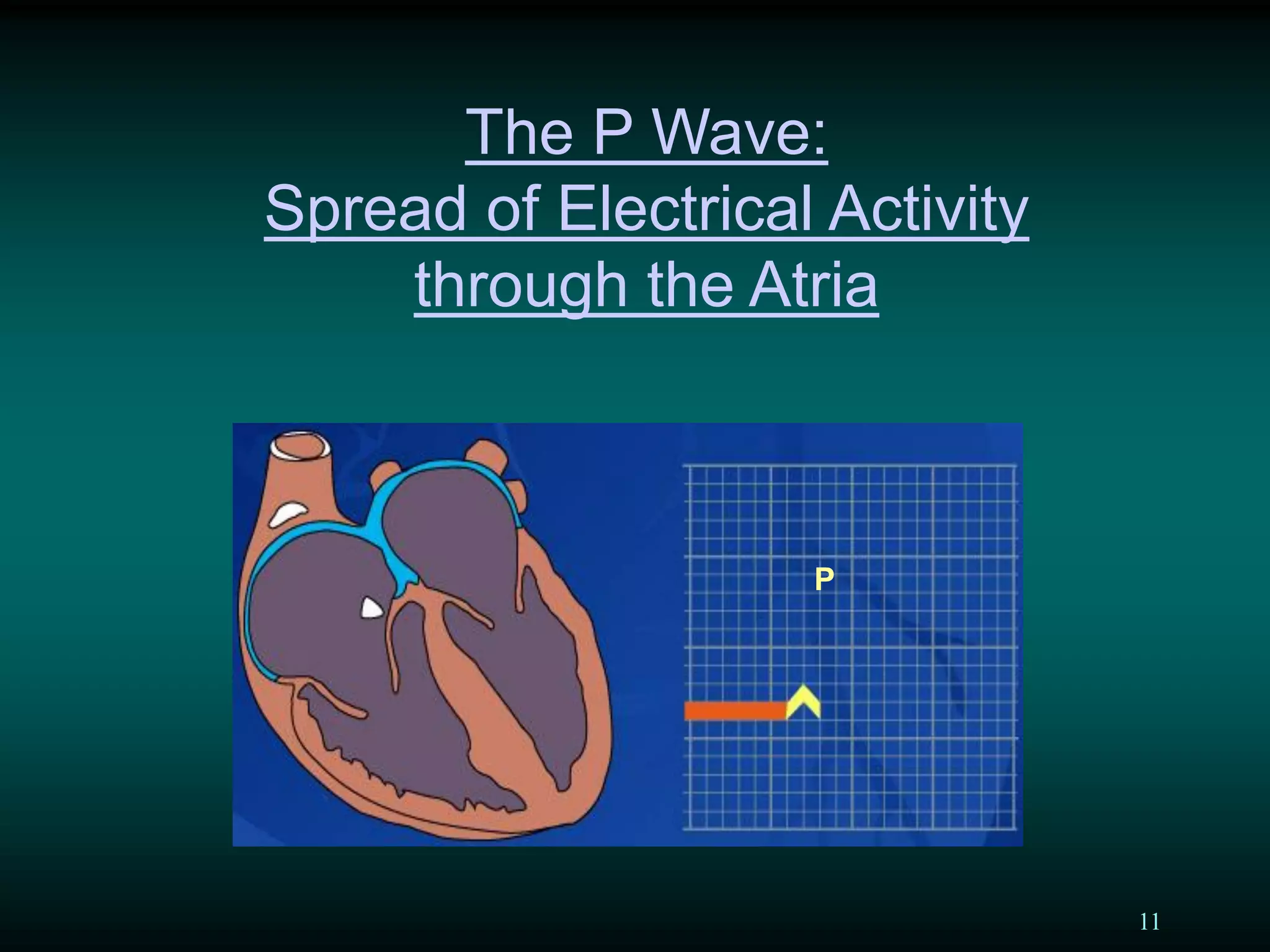 11
The P Wave:
Spread of Electrical Activity
through the Atria
P
 