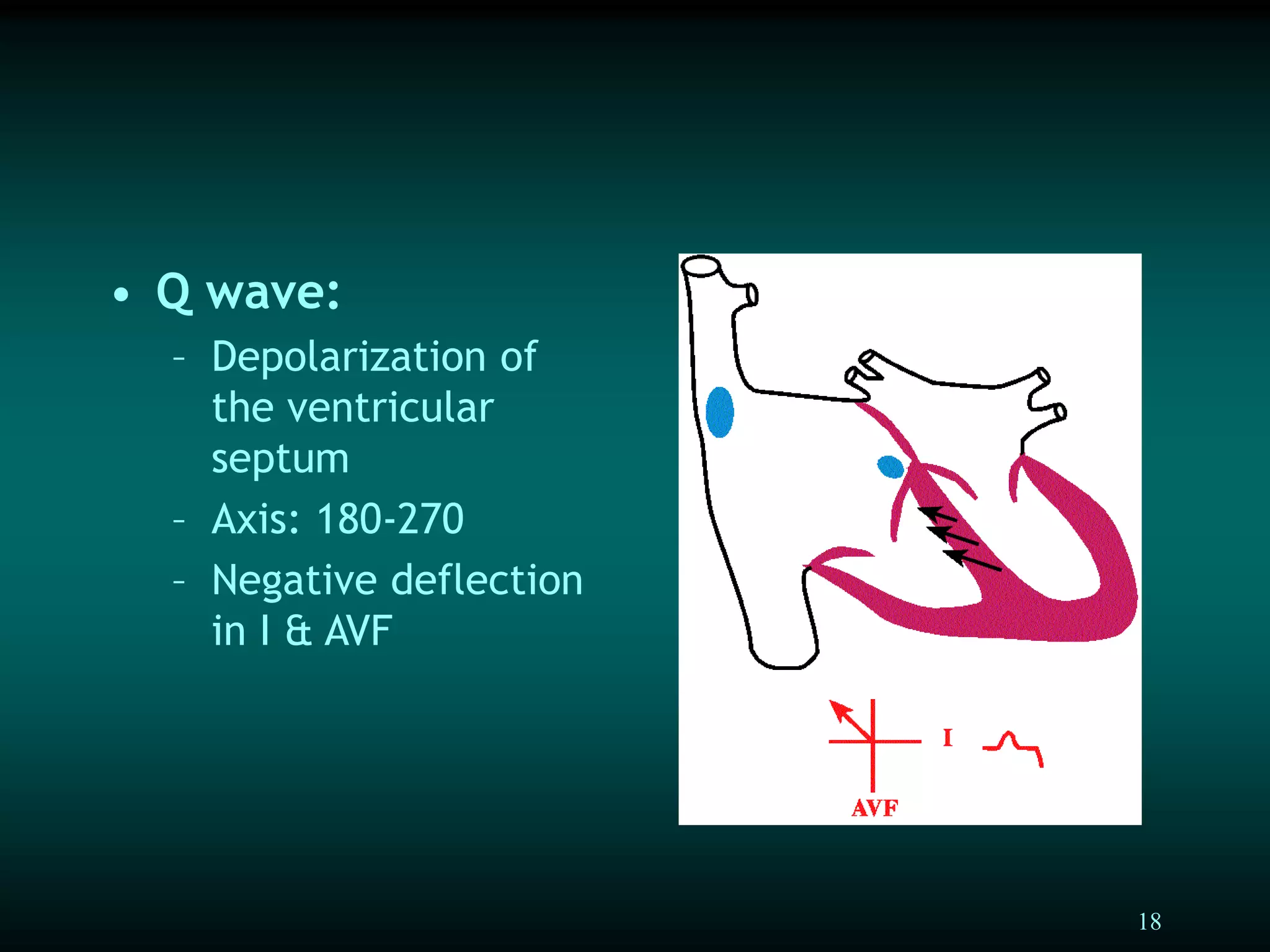 18
• Q wave:
– Depolarization of
the ventricular
septum
– Axis: 180-270
– Negative deflection
in I & AVF
 