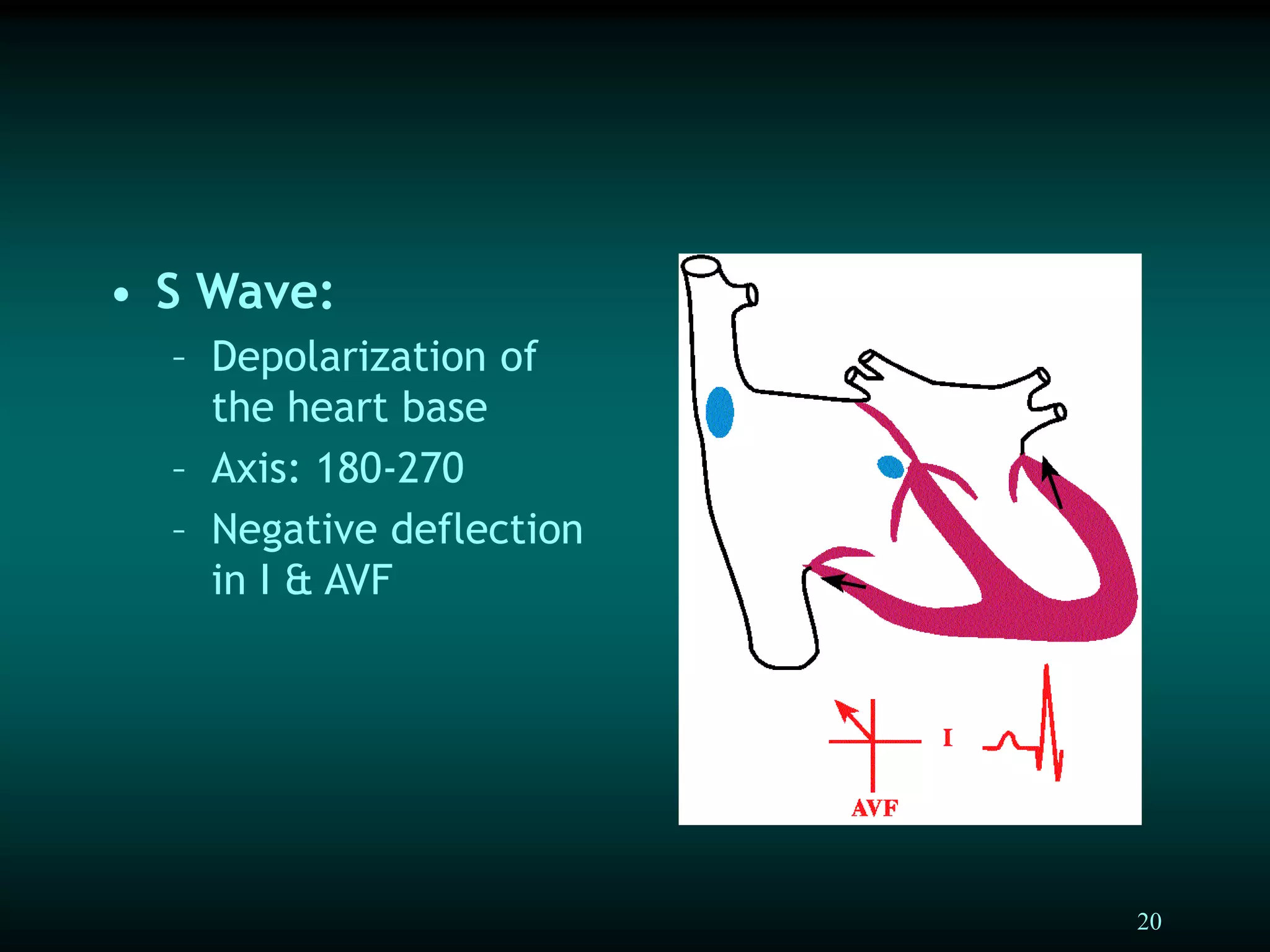 20
• S Wave:
– Depolarization of
the heart base
– Axis: 180-270
– Negative deflection
in I & AVF
 