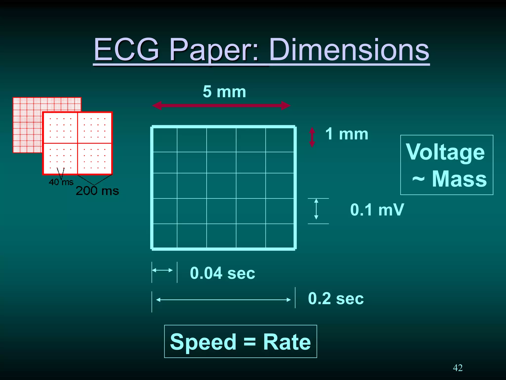 42
ECG Paper: Dimensions
5 mm
1 mm
0.1 mV
0.04 sec
0.2 sec
Speed = Rate
Voltage
~ Mass
 