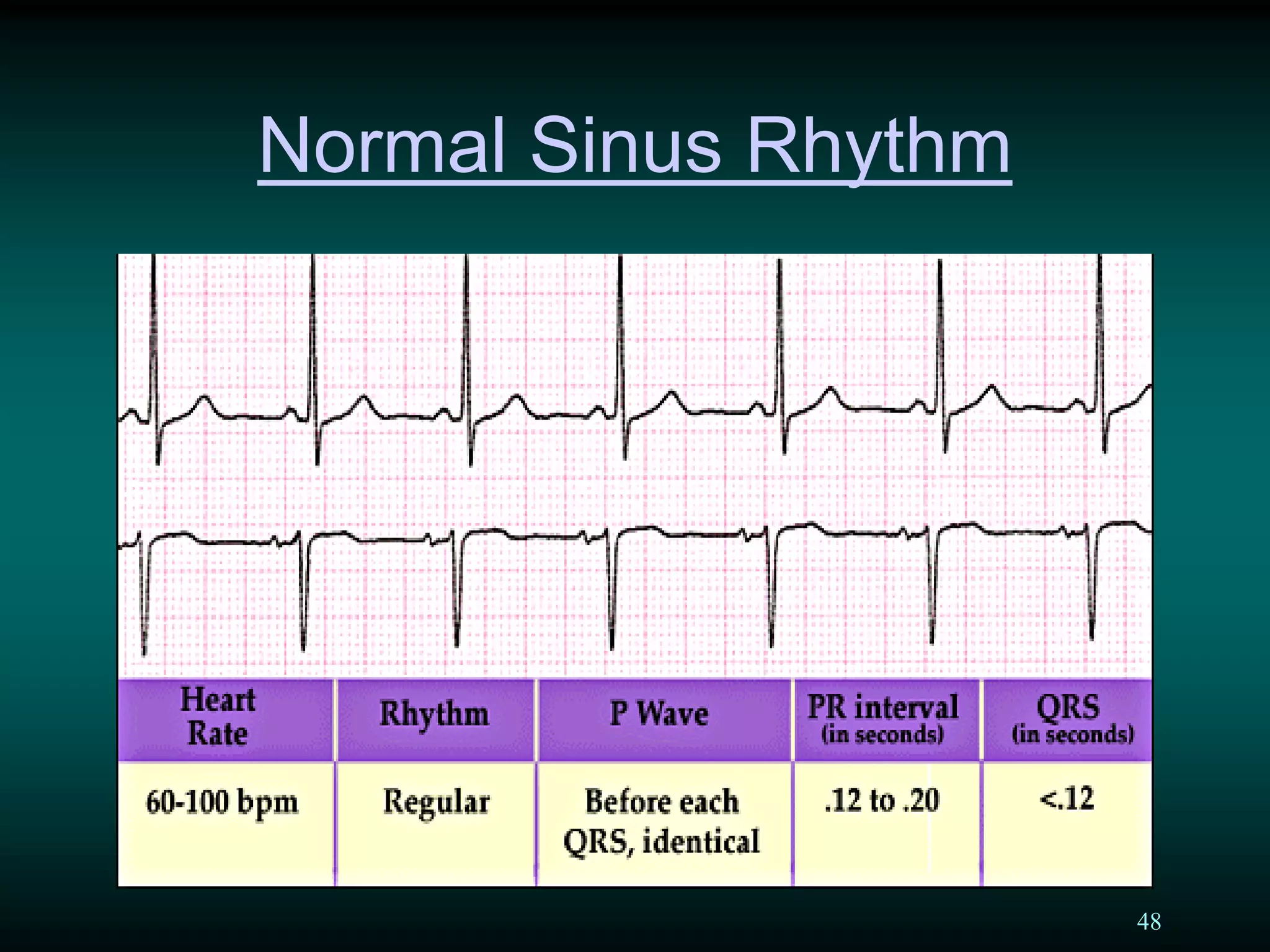 48
Normal Sinus Rhythm
 