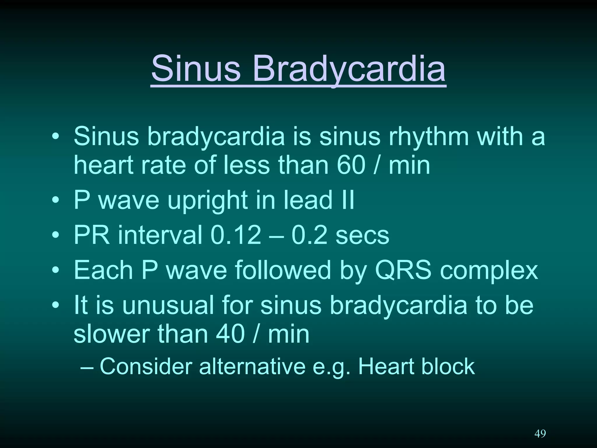 49
Sinus Bradycardia
• Sinus bradycardia is sinus rhythm with a
heart rate of less than 60 / min
• P wave upright in lead II
• PR interval 0.12 – 0.2 secs
• Each P wave followed by QRS complex
• It is unusual for sinus bradycardia to be
slower than 40 / min
– Consider alternative e.g. Heart block
 