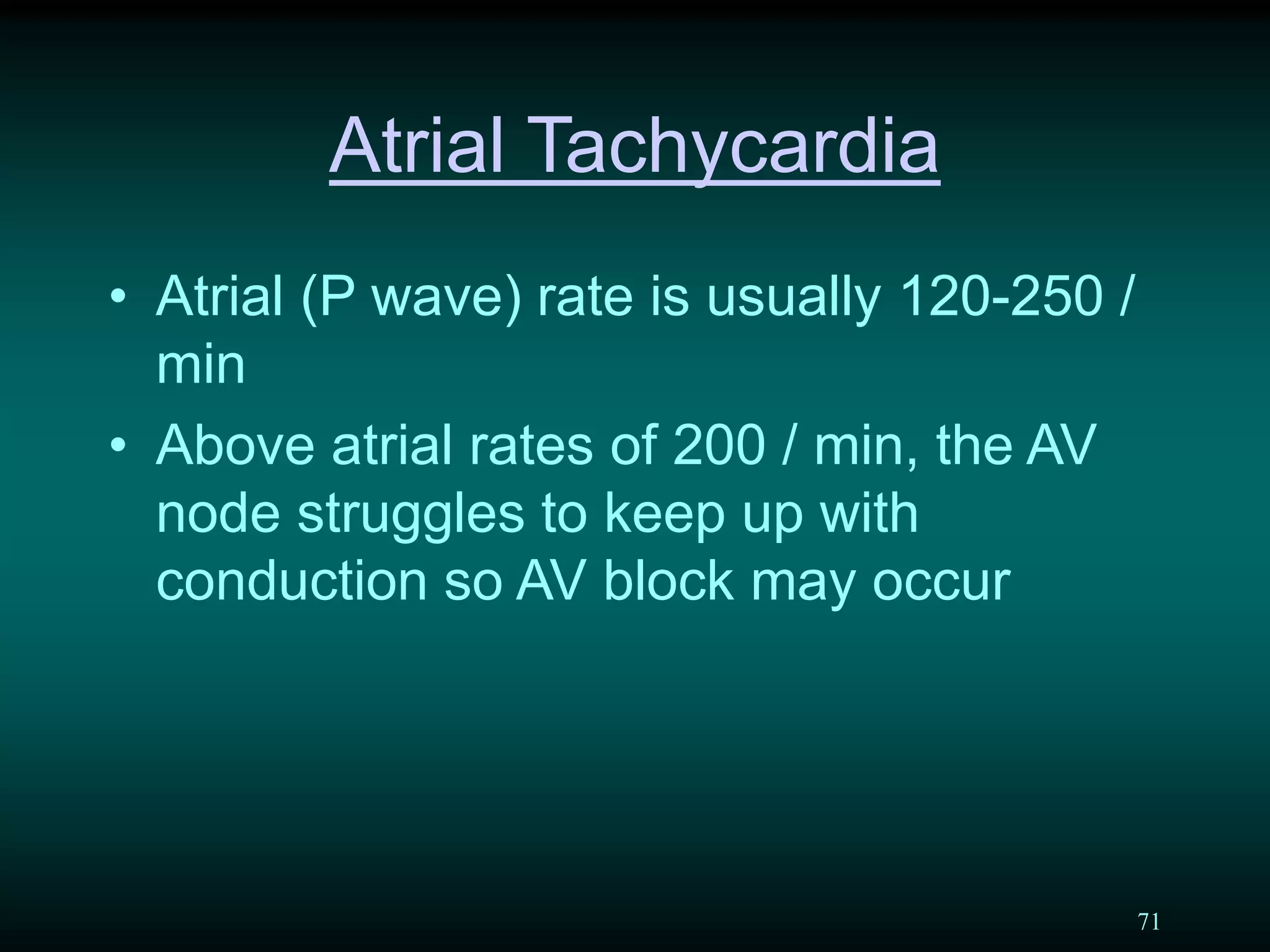 71
Atrial Tachycardia
• Atrial (P wave) rate is usually 120-250 /
min
• Above atrial rates of 200 / min, the AV
node struggles to keep up with
conduction so AV block may occur
 
