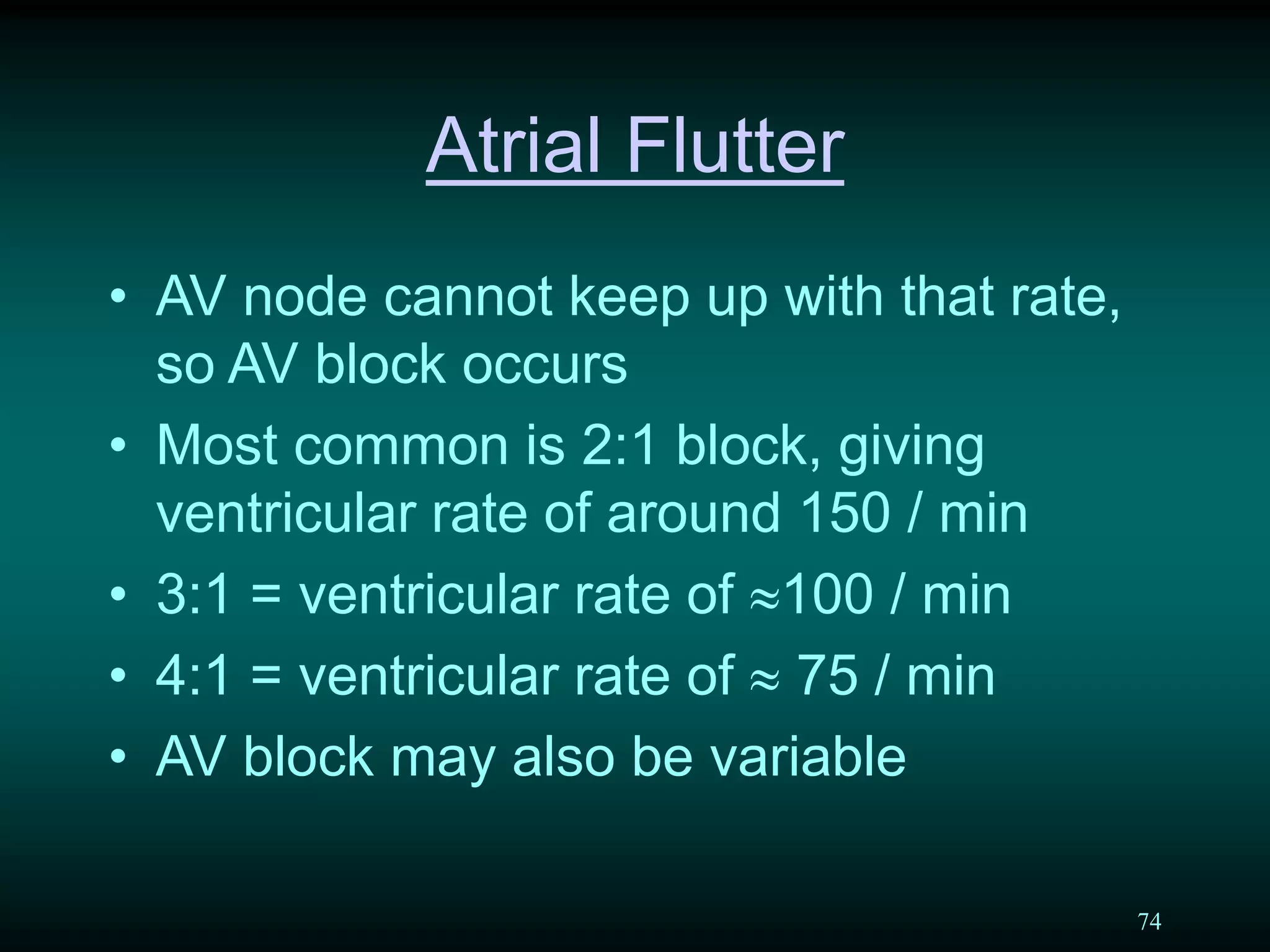 74
Atrial Flutter
• AV node cannot keep up with that rate,
so AV block occurs
• Most common is 2:1 block, giving
ventricular rate of around 150 / min
• 3:1 = ventricular rate of 100 / min
• 4:1 = ventricular rate of  75 / min
• AV block may also be variable
 
