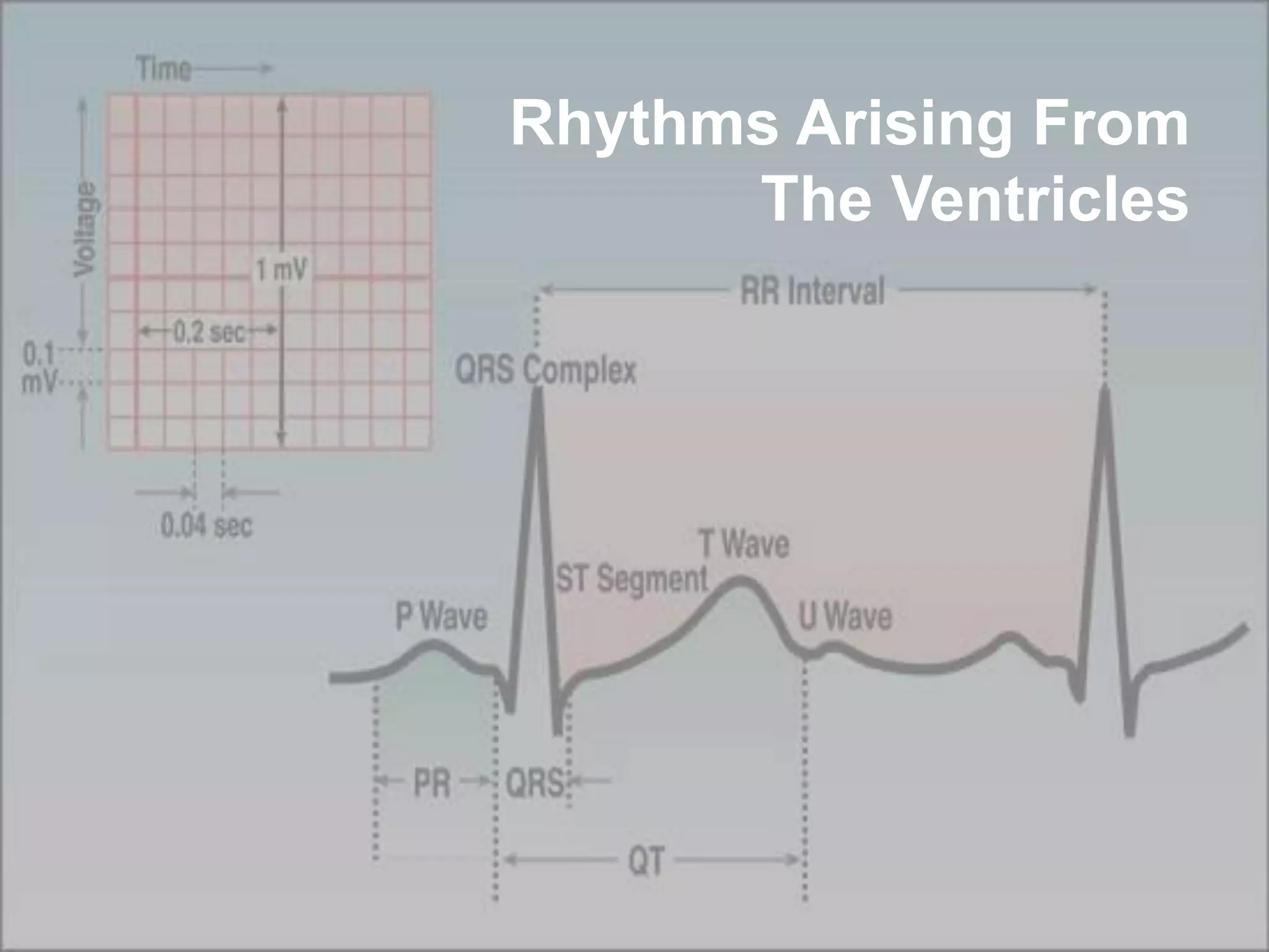 82
Rhythms Arising From
The Ventricles
 