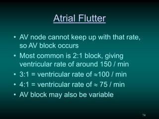 An overview of paediatric ECG | PDF