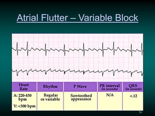 An overview of paediatric ECG | PDF