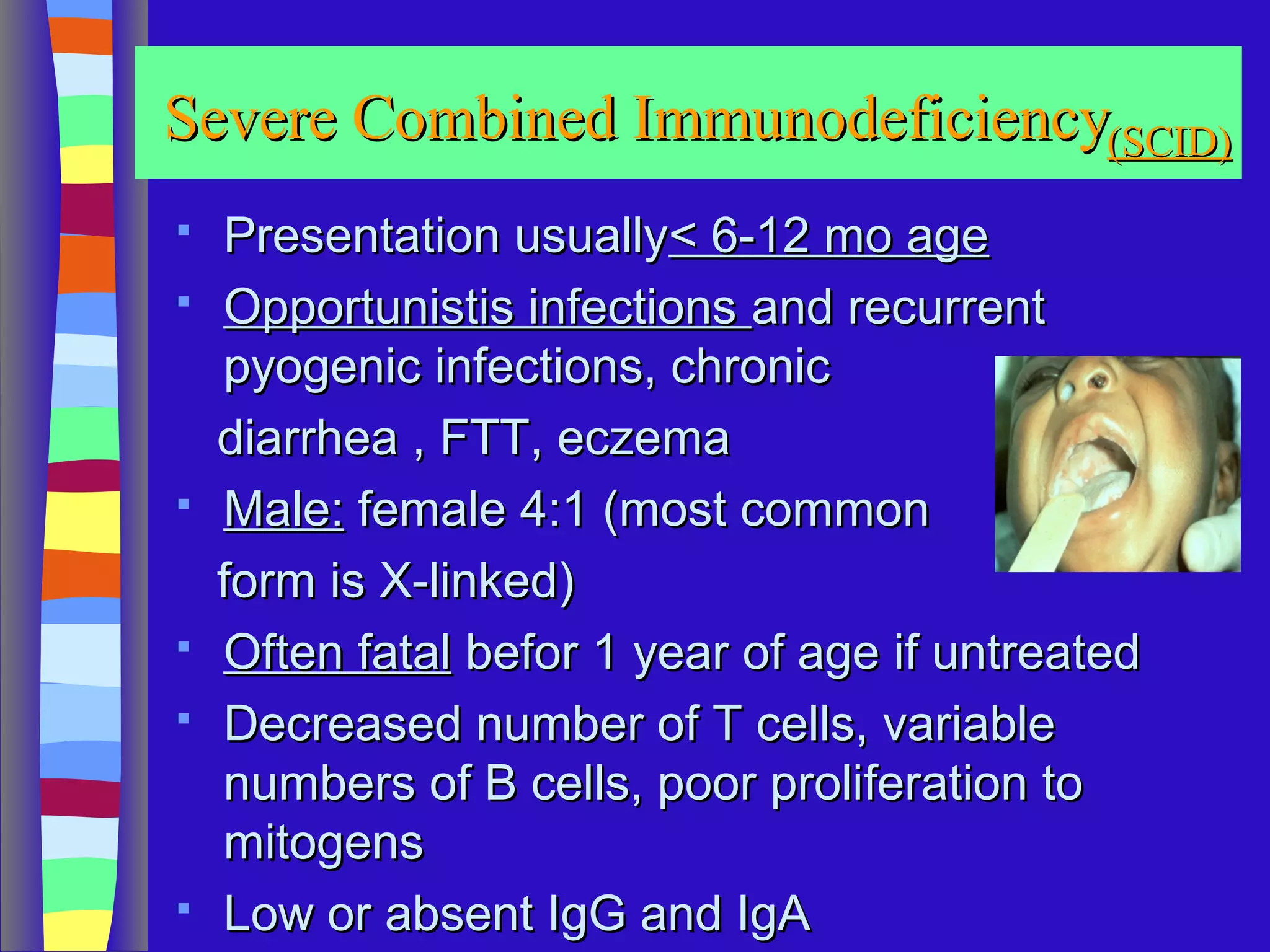 An overview of primary immunodeficiency diseases 2014 | PPT