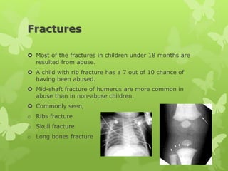 Fractures
 Most of the fractures in children under 18 months are
resulted from abuse.
 A child with rib fracture has a 7 out of 10 chance of
having been abused.
 Mid-shaft fracture of humerus are more common in
abuse than in non-abuse children.
 Commonly seen,
o Ribs fracture
o Skull fracture
o Long bones fracture
 