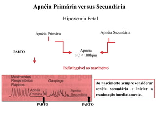 Ao nascimento sempre considerar
apnéia secundária e iniciar a
reanimação imediatamente.
Apnéia Primária versus Secundária
Hipoxemia Fetal
Apnéia Primária Apnéia Secundária
Apnéia
FC < 100bpm
PARTO
PARTO
PARTO
 