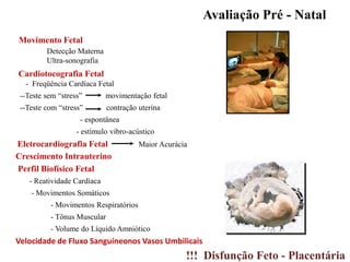 - Freqüência Cardíaca Fetal
--Teste sem “stress” movimentação fetal
--Teste com “stress” contração uterina
- espontânea
- estímulo vibro-acústico
Avaliação Pré - Natal
Movimento Fetal
Detecção Materna
Ultra-sonografia
Cardiotocografia Fetal
Eletrocardiografia Fetal Maior Acurácia
Crescimento Intrauterino
Perfil Biofísico Fetal
- Reatividade Cardíaca
- Movimentos Somáticos
- Movimentos Respiratórios
- Tônus Muscular
- Volume do Líquido Amniótico
Velocidade de Fluxo Sanguíneonos Vasos Umbilicais
!!! Disfunção Feto - Placentária
 