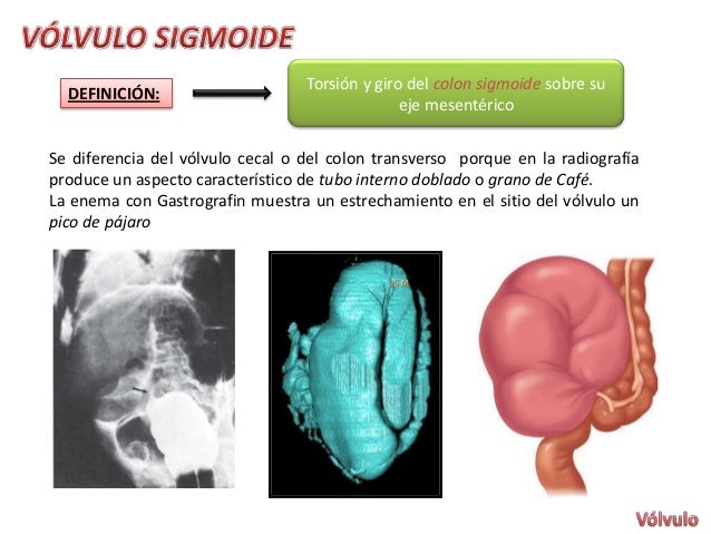 Ano y recto