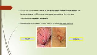  El principal síntoma es el DOLOR INTENSO durante la defecación que persiste tras
la misma durante 10-30 minutos; que puede acompañarse de rectorragia
autolimitada e hipertonía del esfínter.
 Hablamos de fisura crónica cuando perdura la clínica más de 6 semanas.
CRÓNICA
AGUDA
 