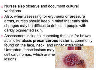  Nurses also observe and document cultural
variations.
 Also, when assessing for erythema or pressure
areas, nurses should keep in mind that early skin
changes may be difficult to detect in people with
darkly pigmented skin.
 Assessment includes inspecting the skin for brown
actinic keratosis precancerous lesions, commonly
found on the face, neck, and upper extremities.
Untreated, these lesions may progress to squamous
cell carcinomas, which are reddish dome-shaped
lesions.
 