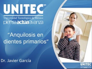 “ Anquilosis en  dientes primarios ” Dr. Javier García 