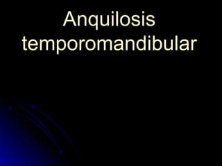 AnquilosisAnquilosis
temporomandibulartemporomandibular
 