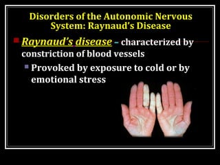 Disorders of the Autonomic Nervous 
System: Hypertension 
 Hypertension – high blood pressure 
Can result from overactiv...