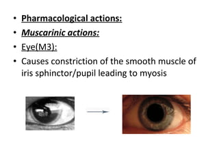 • Pharmacological actions:
• Muscarinic actions:
• Eye(M3):
• Causes constriction of the smooth muscle of
iris sphinctor/pupil leading to myosis
 