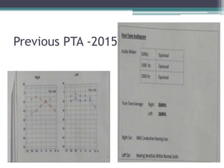 Previous PTA -2015
 