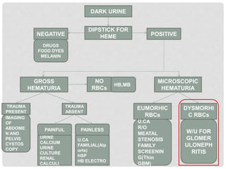 DARK URINE
DIPSTICK FOR
HEMENEGATIVE
DRUGS
FOOD DYES
MELANIN
POSITIVE
GROSS
HEMATURIA
MICROSCOPIC
HEMATURIA
TRAUMA
PRESENT
TRAUMA
ABSENT
IMAGING
OF
ABDOME
N AND
PELVIS
CYSTOS
COPY
PAINFUL PAINLESS
URINE
CALCIUM
URINE
CULTURE
RENAL
CALCULI
U.CA
FAMILIAL(Alp
orts)
HSP
HB ELECTRO
EUMORHIC
RBCs
DYSMORHI
C RBCs
U.CA
R/O
MEATAL
STENOSIS
FAMILY
SCREENIN
G(Thin
GBM)
W/U FOR
GLOMER
ULONEPH
RITIS
NO
RBCs
HB,MB
 