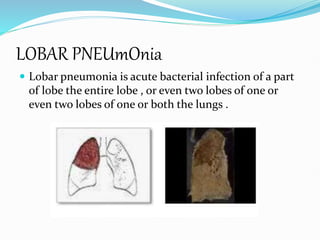 Pneumonia disease symptoms Care prevention and causes | PPTX