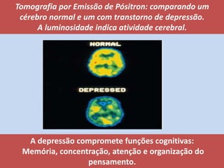 A depressão compromete funções cognitivas:
Memória, concentração, atenção e organização do
pensamento.
Tomografia por Emissão de Pósitron: comparando um
cérebro normal e um com transtorno de depressão.
A luminosidade indica atividade cerebral.
 