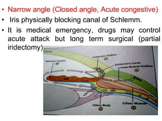 • Narrow angle (Closed angle, Acute congestive)
• Iris physically blocking canal of Schlemm.
• It is medical emergency, drugs may control
acute attack but long term surgical (partial
iridectomy)
 