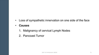 • Loss of sympathetic innervation on one side of the face
• Causes
1. Malignancy of cervical Lymph Nodes
2. Pancoast Tumor
DEPT. OF PHYSIOLOGY, GMCM 75
 