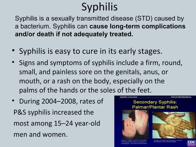 an-std-powerpoint-ppt