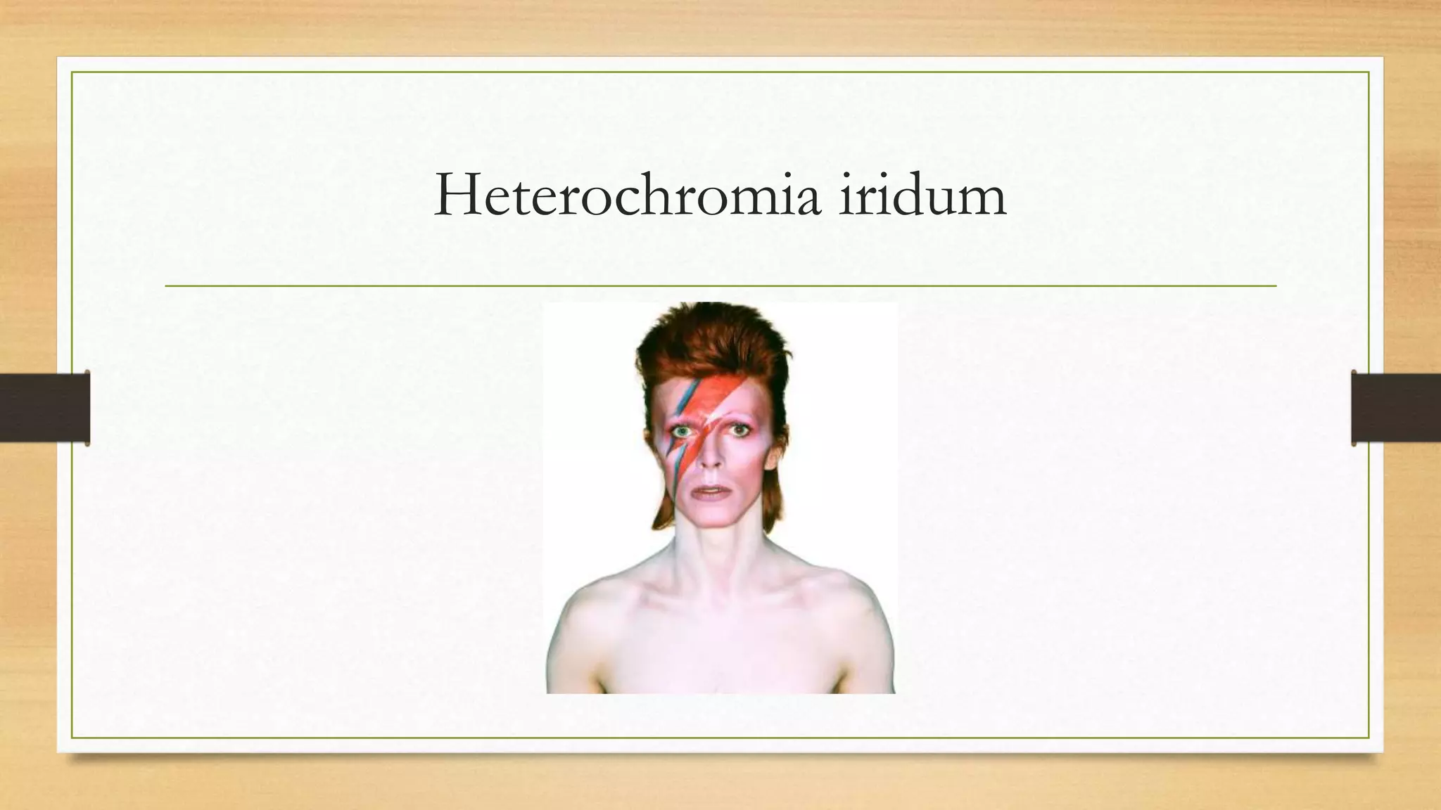 Heterochromia iridum
 