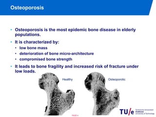 Osteoporosis 
• Osteoporosis is the most epidemic bone disease in elderly 
populations. 
• It is characterized by: 
• low bone mass 
• deterioration of bone micro-architecture 
• compromised bone strength 
• It leads to bone fragility and increased risk of fracture under 
low loads. 
Healthy Osteoporotic 
PAGE 4 
 