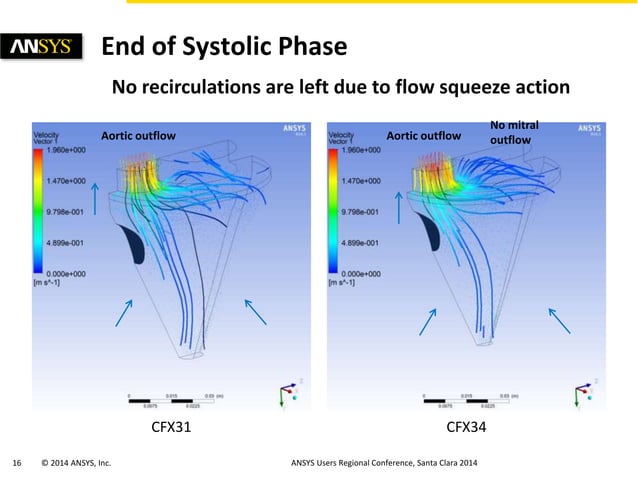 Simulations of Hypertrophic Obstructive Cardiomyopathy (HOCM) in a ...