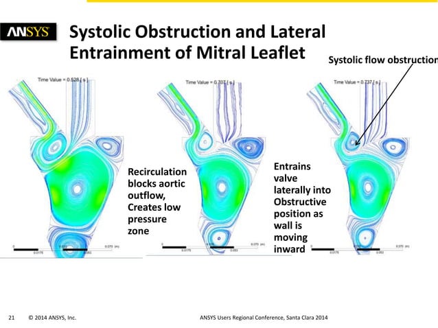 Simulations of Hypertrophic Obstructive Cardiomyopathy (HOCM) in a ...