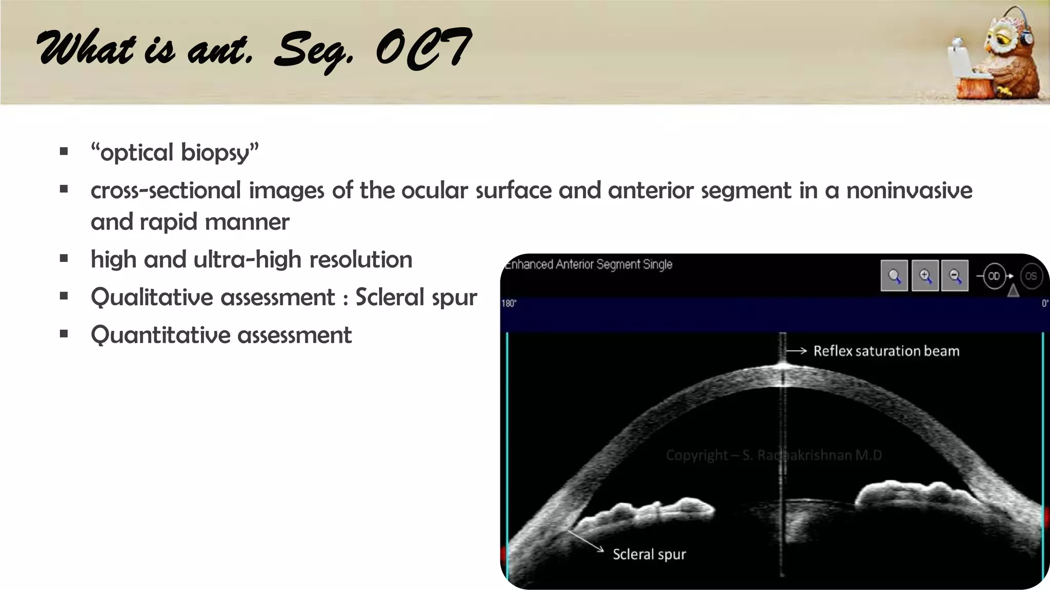 What is ant. Seg. OCT
“optical biopsy”
cross-sectional images of the ocular surface and anterior segment in a noninvasive
and rapid manner
high and ultra-high resolution
Qualitative assessment : Scleral spur
Quantitative assessment