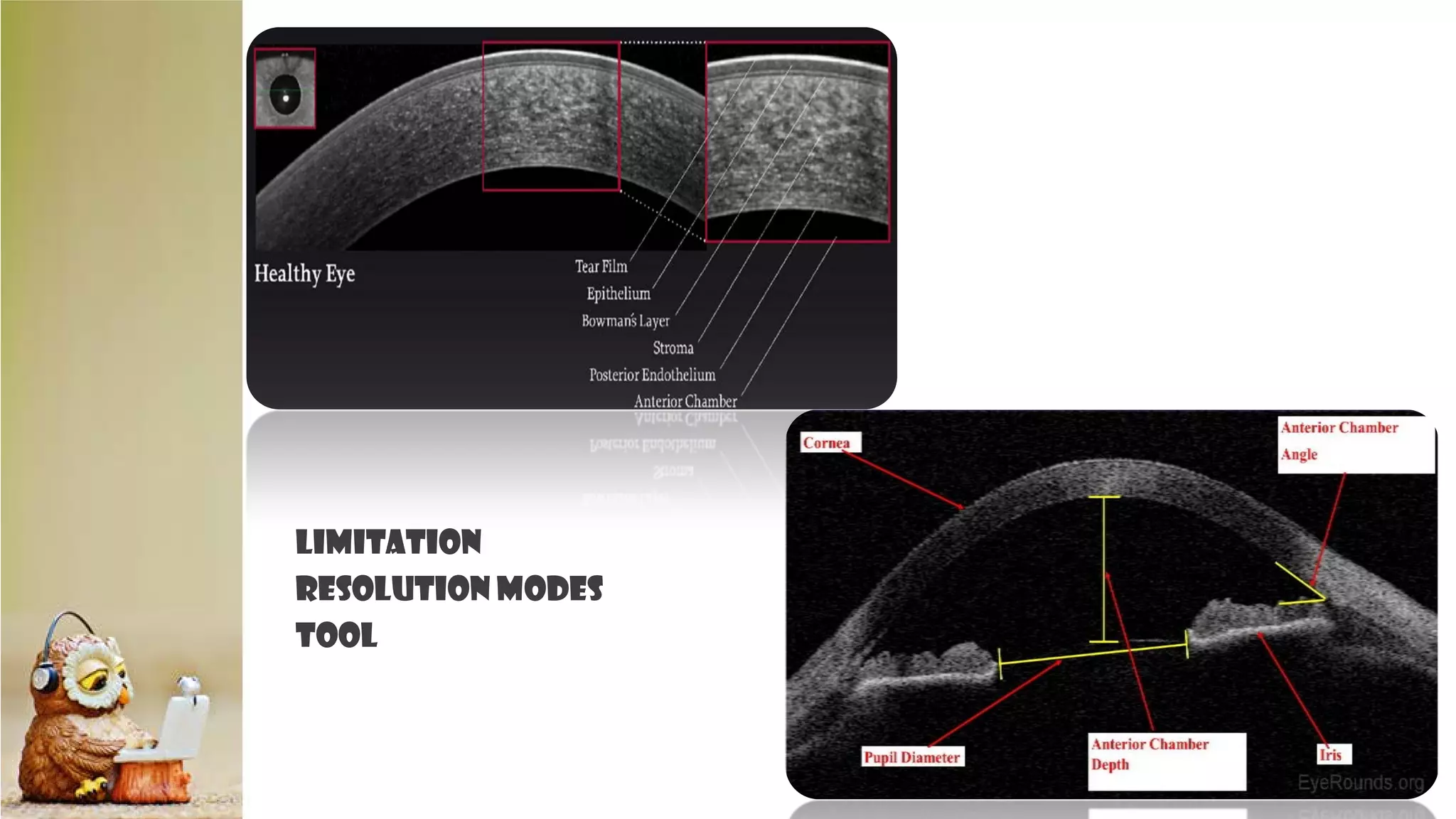 LIMITATION
RESOLUTION MODES
TOOL