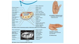 Key Hand Structures Comprehensive Gross Anatomy of the Human Hand and Limb Structures | PPTX