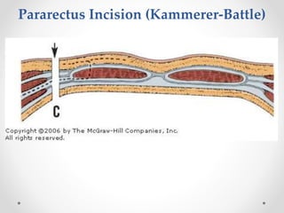 Surgical Anatomy of anterior abdominal wall | PPTX